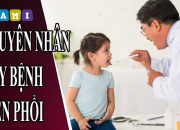 Nguyên Nhân Gây Bệnh Viêm Phổi – 2Mami.vn