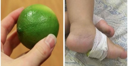 Phương pháp dùng chanh HẠ SỐT TỨC THỜI nhưng bác sỹ nói KHÔNG!