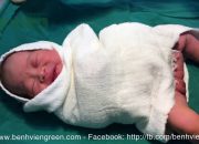 Chăm sóc rốn cho trẻ sơ sinh tại Bệnh viện Quốc tế Green