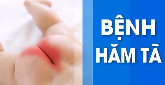 Hướng dẫn cách chăm sóc khi trẻ bị hăm tã | Vui khỏe mỗi ngày