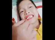 Hướng dẫn chăm sóc răng miệng cho bé bằng Thuốc đặc trị răng miệng Nhật Dương