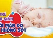 Chăm Sóc Trẻ Sơ Sinh Nổi Mẩn Đỏ Khắp Người Không Sốt