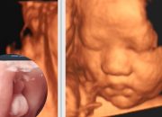 Video siêu âm thai nhi 31 tuần: Đây là 1 bé trai rất đáng iu|| Video siêu âm 31 tuần tuổi